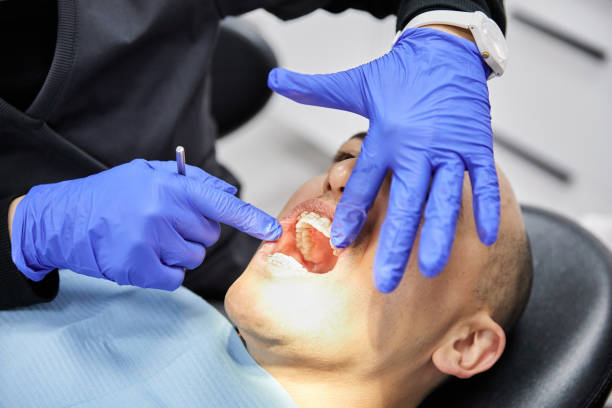 Best Emergency Dental Care for Broken or Chipped Teeth in Tioga Terrace, NY